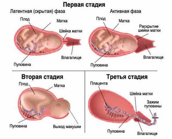 Что такое эпизиотомия и когда требуется