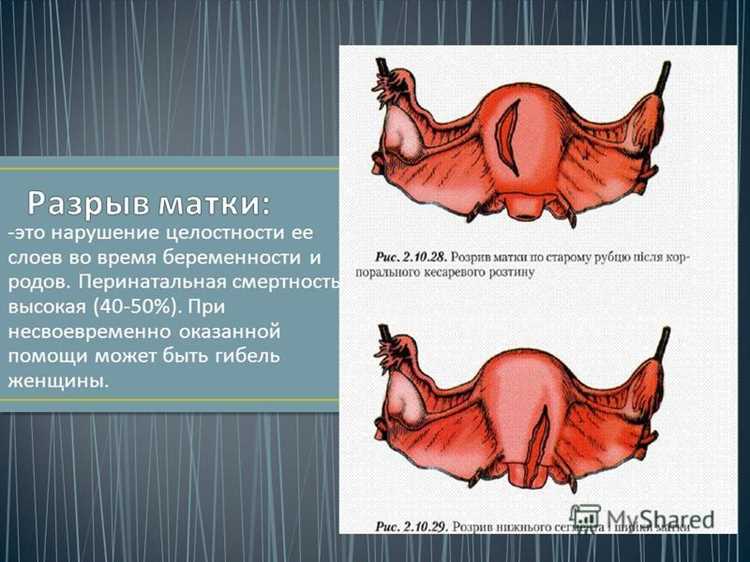 Процесс выполнения эпизиотомии: этапы и техники