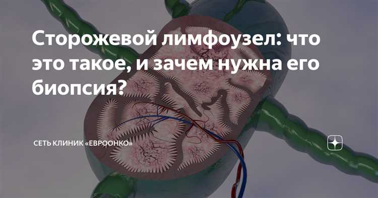 Определение
