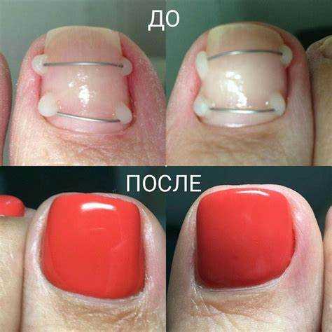Советы