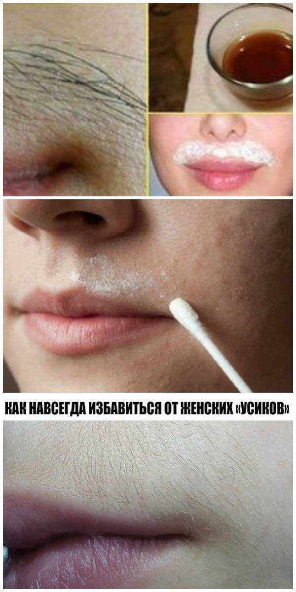 Усы